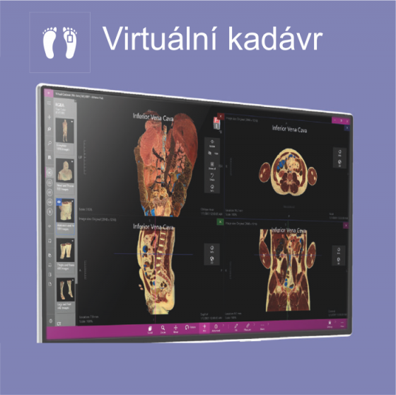 AthenaHUB-vrituální kadávr